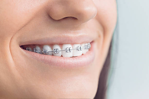 Best Tooth Extraction  in Fris, CO